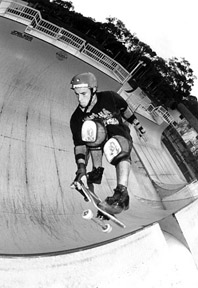 fraizerbone1.jpg
